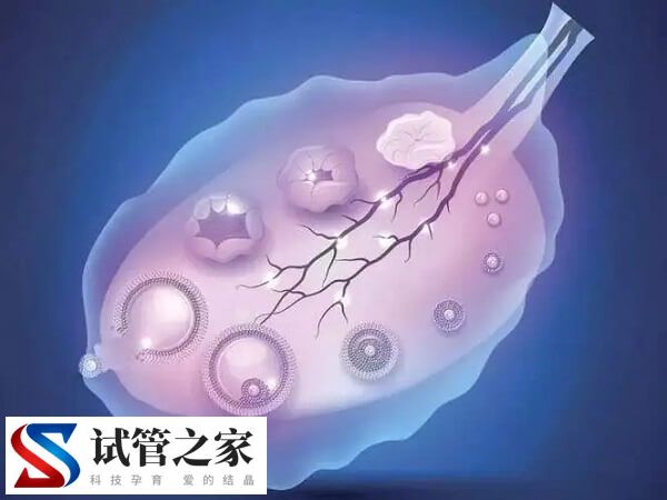 多囊促排前要做什么准备(图1)