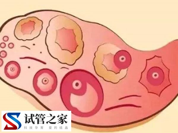 试管婴儿长方案vs短方案，选对了成功率倍增！(图1)