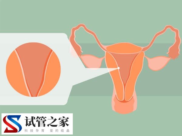子宫内膜薄是什么原因(图1)