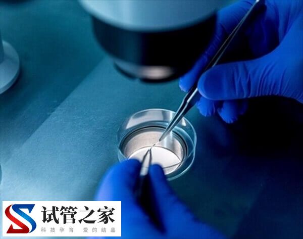30岁试管移植成功率多高(图1)