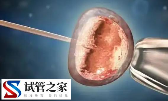 自己在家里用针管做人工授精能成功吗?(图1)