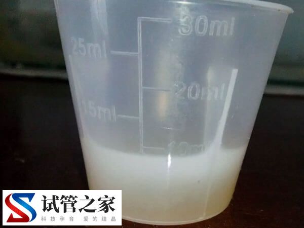一代试管婴儿对精子的要求是什么(图2)