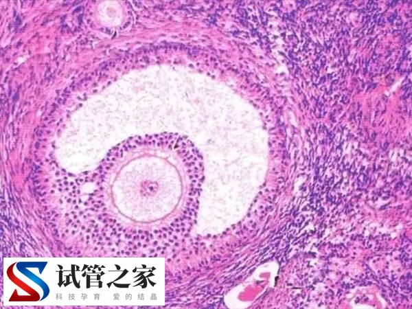 试管婴儿要不要天天做b超(图2)
