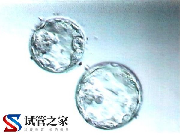 囊胚解冻后又冻回去有无损伤(图1)