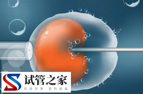 大姨妈第二天可以做试管移植胚胎吗?浏览量4 评论0(图1)