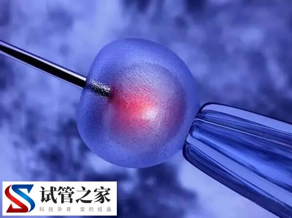 试管婴儿有几个步骤(图1)