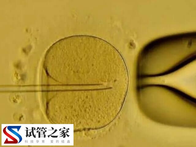 囊胚移植第八天白板还有没有希望(图1)