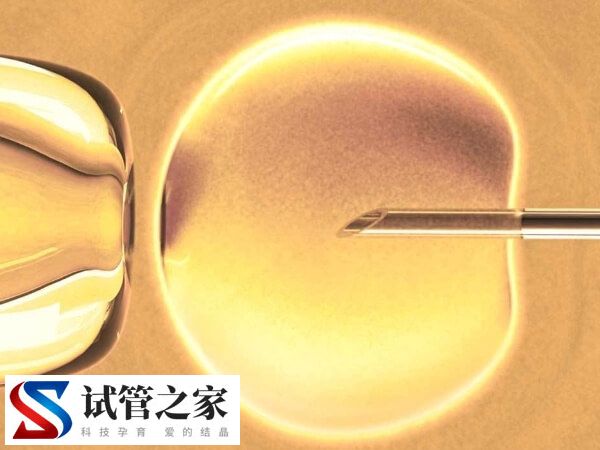 卵泡期长方案适合哪些人(图1)