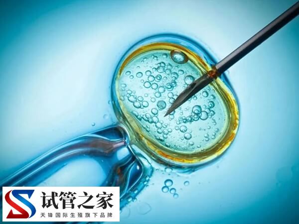 拮抗剂促排方案有什么优点(图2)