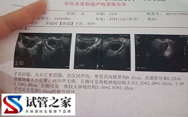 做试管婴儿都有哪些步骤(图1)