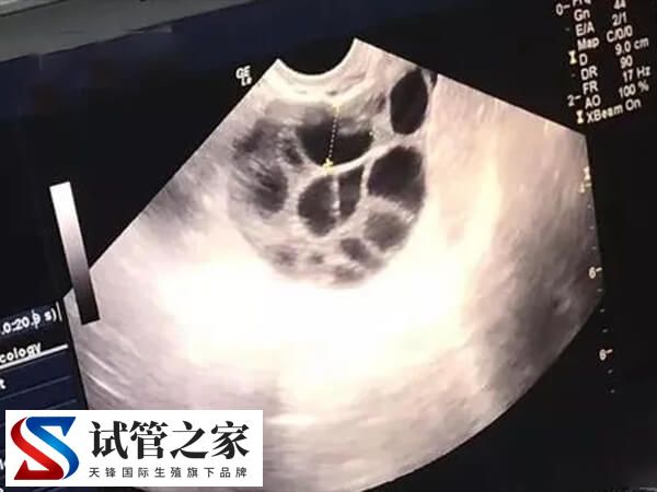 试管婴儿的检查项目有哪些(图1)