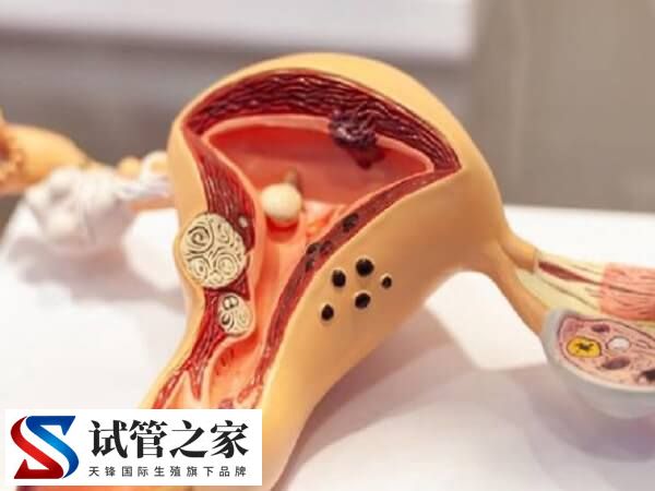 移植胚胎对子宫有没有要求(图1)