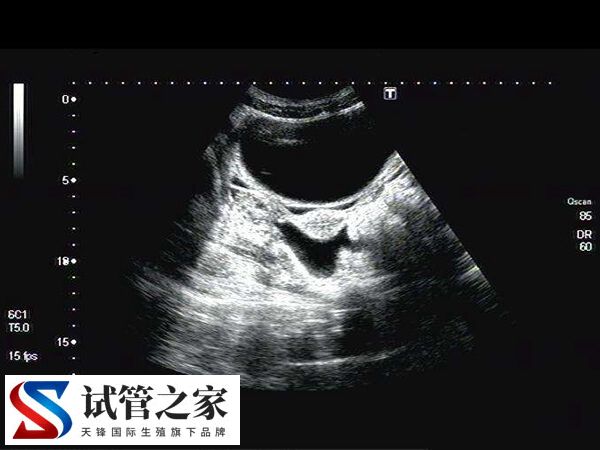 移植胚胎对子宫有没有要求(图2)
