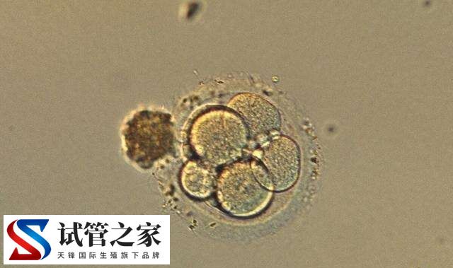 为什么养囊有的5天有的6天(图3)