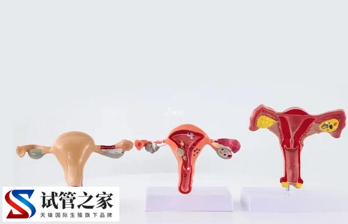 试管取卵后腹水能按摩(图1)
