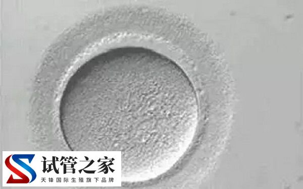 做试管卵子透明异常怎么办(图1)