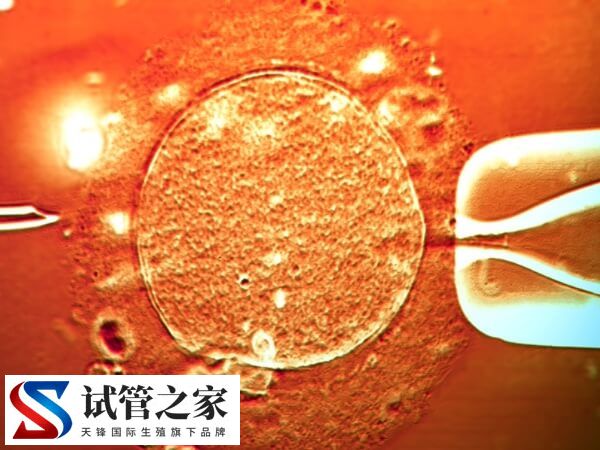 做试管卵子透明异常怎么办(图2)