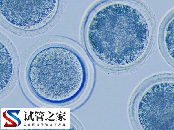 多囊促排卵要注意什么(图1)