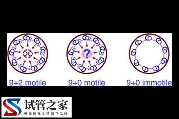做三代试管能否改善RSPH3基因突变(图2)