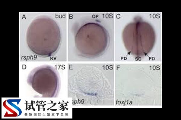 RSPH9基因突变能否做试管(图1)