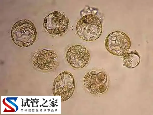 胚胎是否会冻坏(图1) 胚胎是否会冻坏(图1)