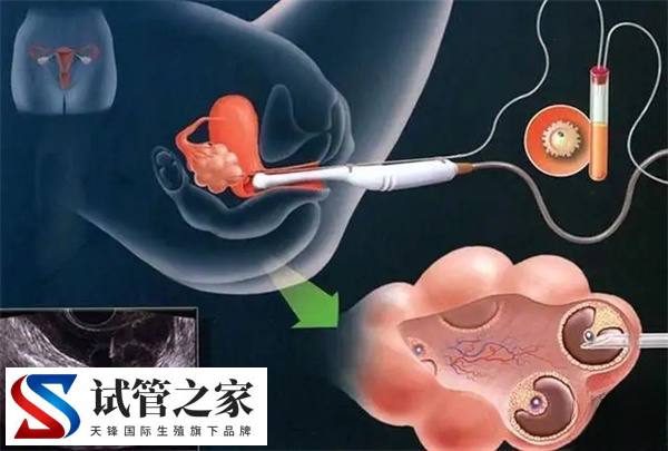 试管取卵和胚胎培养哪个好(图2)