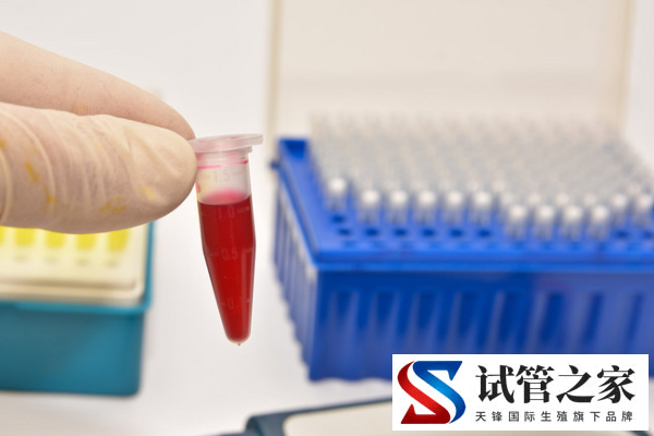 rh阴性血可以生二胎吗,rh阴性o型血会更容易出现输血反应吗(图1) rh阴性血可以生二胎吗,rh阴性o型血会更容易出现输血反应吗(图1)