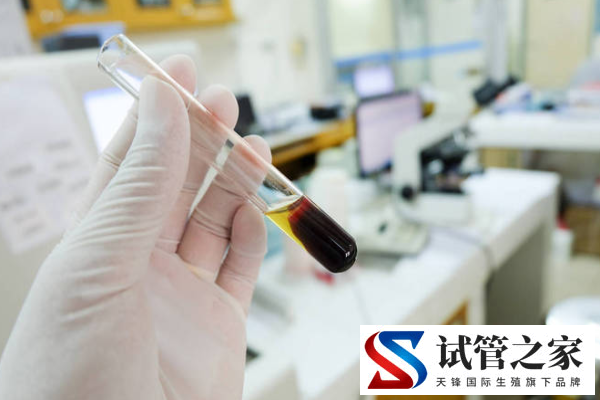 rh阴性血可以生二胎吗,rh阴性o型血会更容易出现输血反应吗(图2) rh阴性血可以生二胎吗,rh阴性o型血会更容易出现输血反应吗(图2)