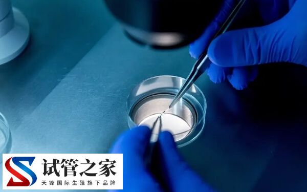 移植囊胚的禁忌是什么(图1)