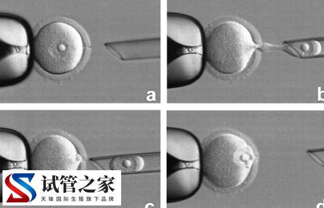 为什么试管只能放一个胚胎(图1)