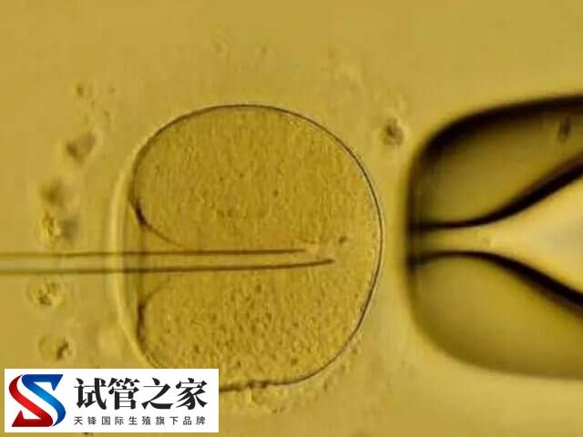 试管移植几枚胚胎好(图2)
