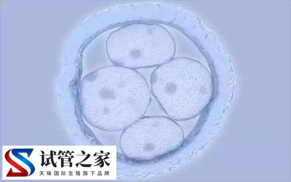 高龄做试管婴儿怎样合理备孕(图1)