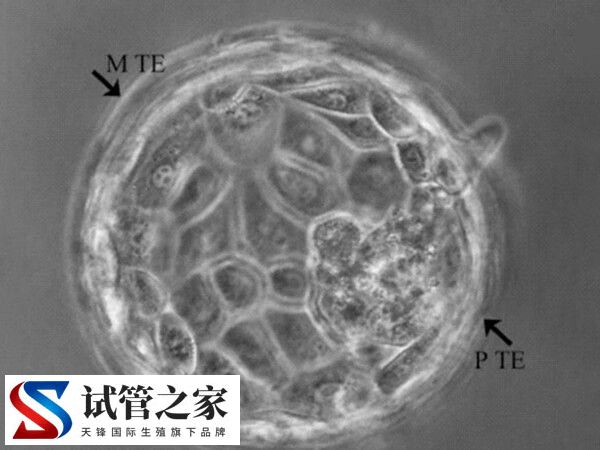 试管囊胚培养容不容易成功(图2)