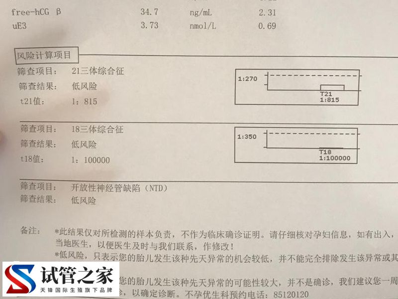 唐氏综合征21号异常染色体引发的危害(图2)