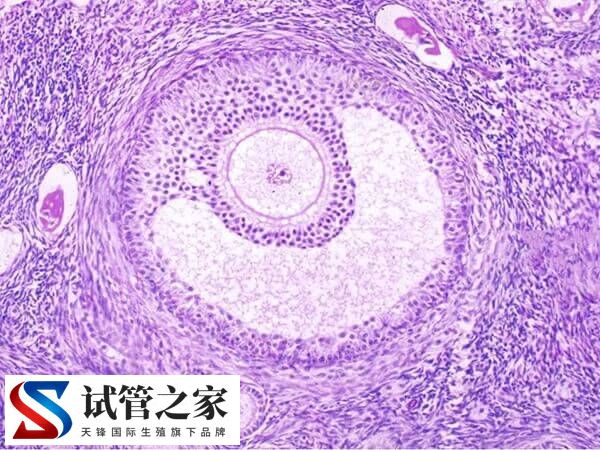 试管婴儿取出来的每个优质卵子都可以配成胚胎吗？(图1)