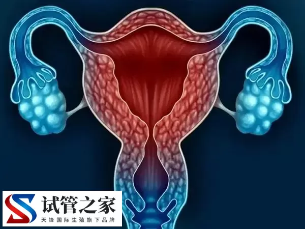 子宫内膜异位会影响女性生育能力，那还可以自然怀孕吗？(图1)