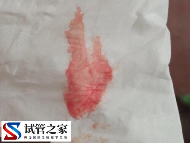 试管婴儿移植后出血的情况分析，手术刺激或为主要原因