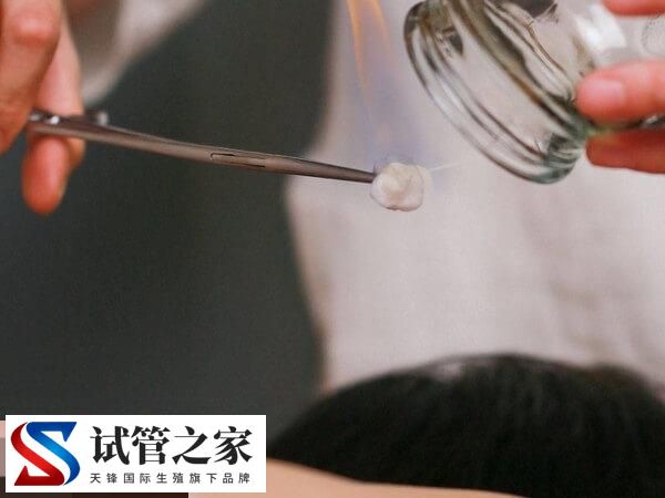 做试管为什么还要求减肥赶紧看，避免影响精卵质量是其一(图2)