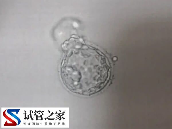 鲜胚移植成功率90%是不是真的(图1) 鲜胚移植成功率90%是不是真的(图1)