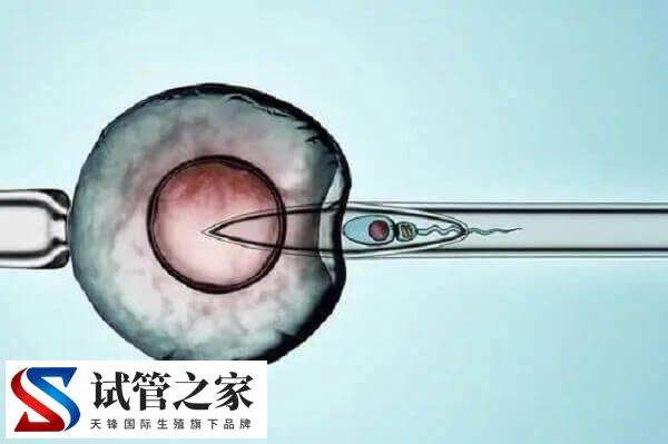 41岁囊胚植入失败4次要清宫(图2) 41岁囊胚植入失败4次要清宫(图2)
