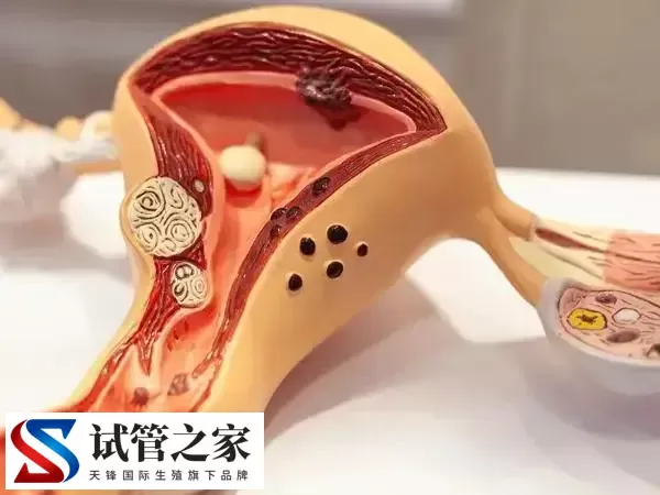 优质囊胚为什么会晚着床(图1) 优质囊胚为什么会晚着床(图1)