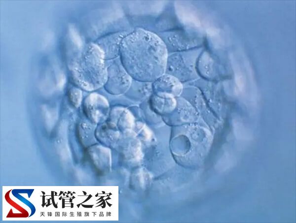 胚胎移植失败后需要注意什么(图1) 胚胎移植失败后需要注意什么(图1)