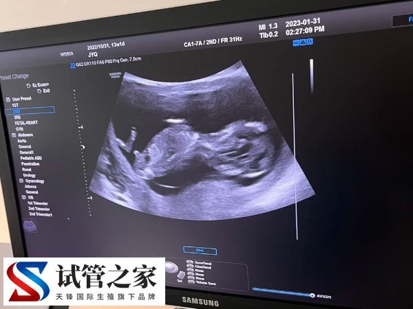 冻囊胚什么时候移植好(图1) 冻囊胚什么时候移植好(图1)