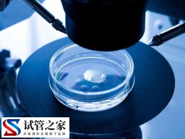 试管婴儿要不要检查弓形虫(图1) 试管婴儿要不要检查弓形虫(图1)