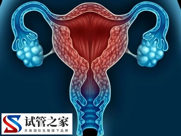 试管婴儿要不要检查弓形虫(图2) 试管婴儿要不要检查弓形虫(图2)