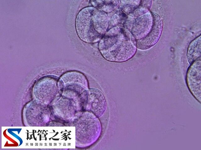 拮抗剂方案可不可以移植鲜胚(图2) 拮抗剂方案可不可以移植鲜胚(图2)