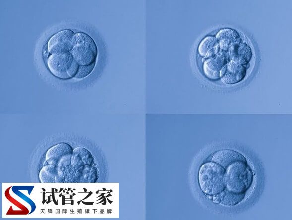 第三代试管婴儿移植6bc囊胚成功率多大(图2) 第三代试管婴儿移植6bc囊胚成功率多大(图2)
