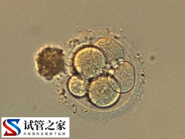 养囊6天了还没结果是好事还是坏事(图1) 养囊6天了还没结果是好事还是坏事(图1)