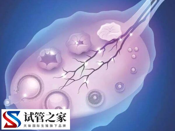 高龄女性去俄罗斯做试管婴儿要怎么做