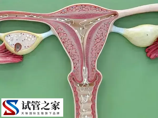 宫颈肥大做试管婴儿会不会影响着床(图3) 宫颈肥大做试管婴儿会不会影响着床(图3)